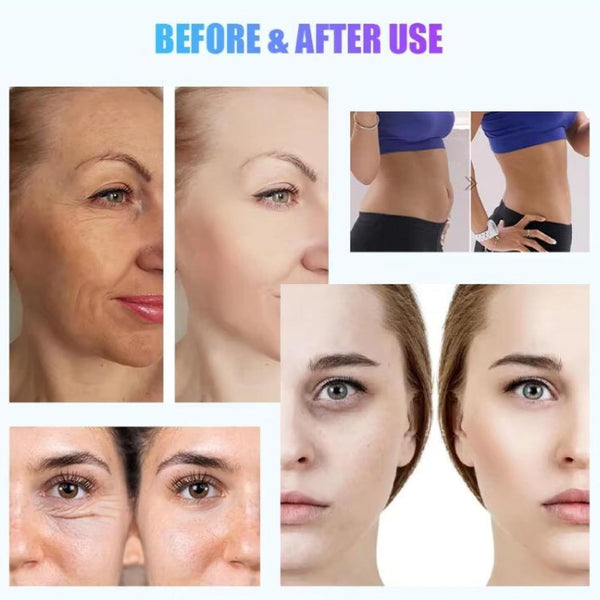 7D Hifu Facial Skin Firming Wrinkle Anti Aging Machine Body Weight Fat Burner