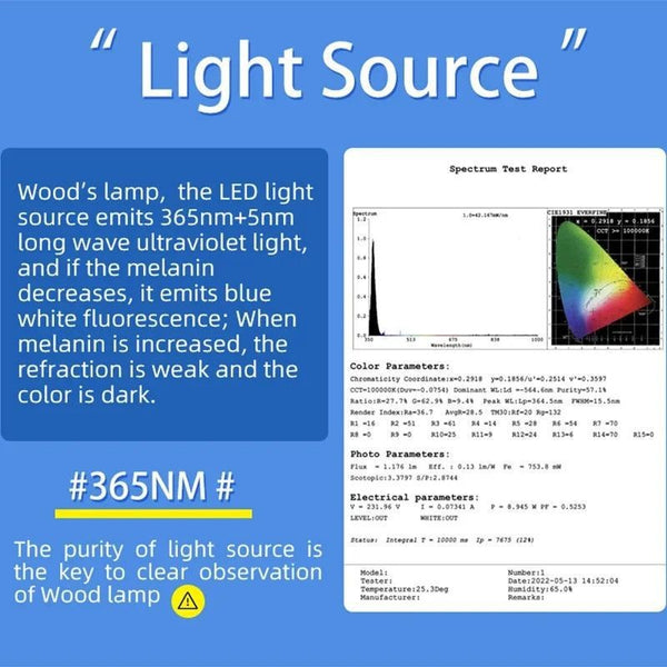 Dermatology Medical LED Woods Lamp Skin Analyzer For Vitiligo Wood's Lamp Skin