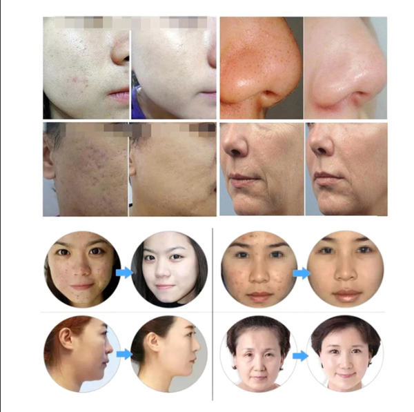 Professional 7 Color LED Facial Photon Light Therapy PDT Lamp Skin Beauty Device