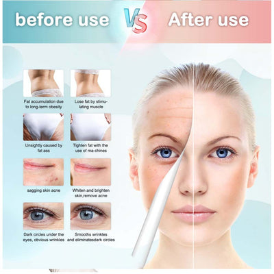 9in1 Ultrasonic Cavitation Machine Home Facial & Body Care Device Body Machine