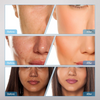 Portable Dcool Cryo Cool Electroporation EMS Mesotherapy Machine Face Skin Lift
