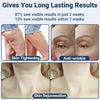Anti Aging RF Face Lifting Device Wrinkle Remover Skin Tightening Beauty Machine