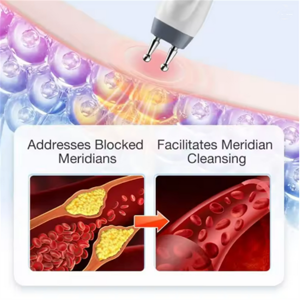 Electronic Acupuncture Pen Meridian Acupressure Point Massage Pulse Therapy
