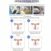 Professional Ultrasound Vaginal Tightening Machine Intensive Rejuvenation Skin