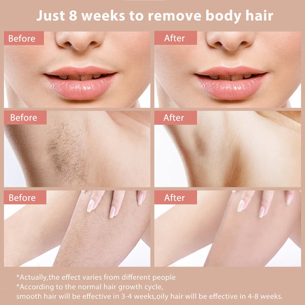 Permanent Hair Removal IPL Laser Ice Point 999,999 Flashes Painless Epilator