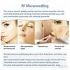 RF Micro-ne-edling Machine w/Cold Hammer-Anti-Aging,Pore Tightening 4 Cartridges