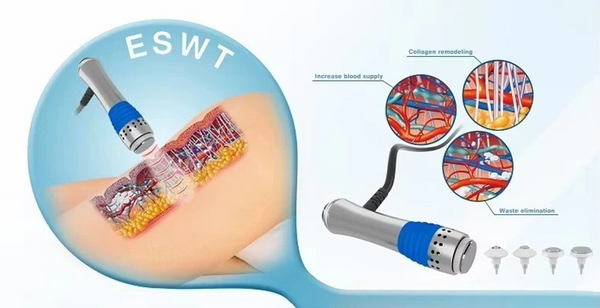 7 Bar ED Shockwave Therapy Machine Effective Electromagnetic Shock Therapy