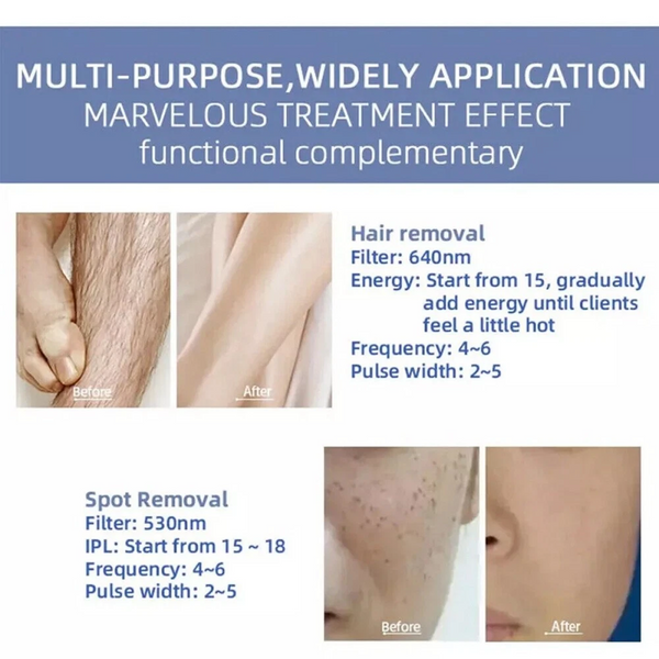 3IN1 OPT IPL RF Tattoo And Hair Removal ND YAG Laser Skin Rejuvenation Machine