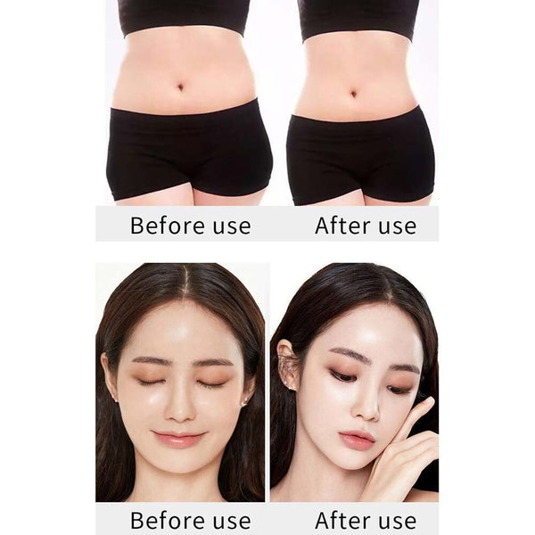 6 in1Ultrasonic Cavitation Machine 40K RF Radio Frequency Fat Body Beauty Device