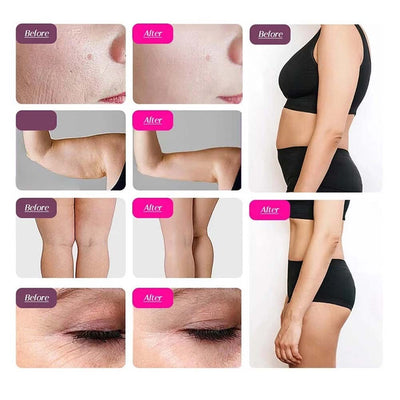 9in1 Ultrasonic Cavitation Machine Home Facial & Body Care Device Body Machine