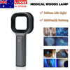Dermatology Medical LED Woods Lamp Skin Analyzer For Vitiligo Wood's Lamp Skin