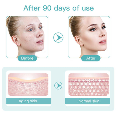 2nd Generation Mini HIFU Machine EMS Face Massage Wrinkle Remove Beauty Device