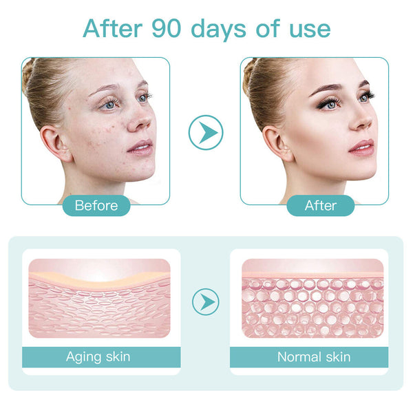 2nd Generation Mini HIFU Machine EMS Face Massage Wrinkle Remove Beauty Device