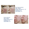 3IN1 OPT IPL RF Tattoo And Hair Removal ND YAG Laser Skin Rejuvenation Machine