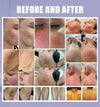 Multi-Functional IPL Photofacial Beauty Machine Nd Yag Laser Handle forSkin Care