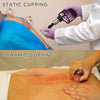 19/30 Cups Vacuum Cupping Set Massage Kit Acupuncture Suction Massager Pain Reli
