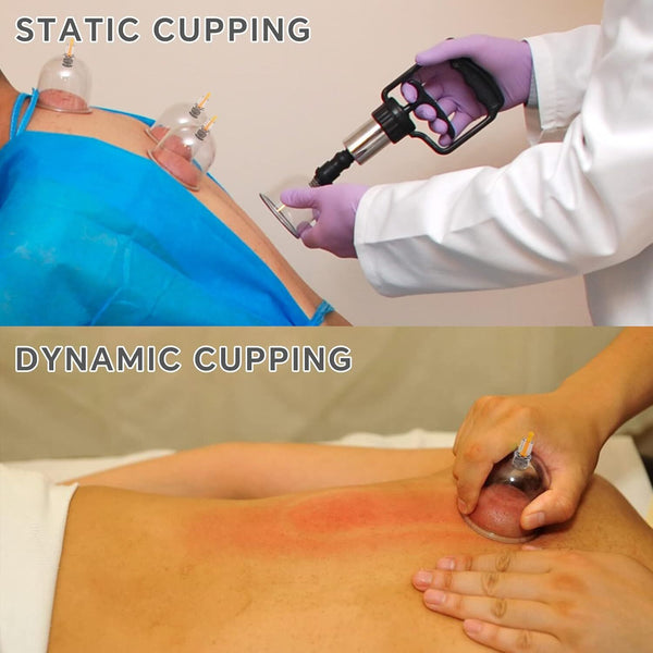 19/30 Cups Vacuum Cupping Set Massage Kit Acupuncture Suction Massager Pain Reli