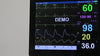 Patient Monitor 8" Vital Sign Human 6-parameter Monitor for ICU/CCU AU PM-9000