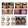 Professional 7 Color LED Facial Photon Light Therapy PDT Lamp Skin Beauty Device