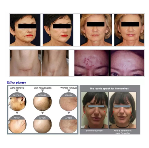 Professional 7 Color LED Facial Photon Light Therapy PDT Lamp Skin Beauty Device