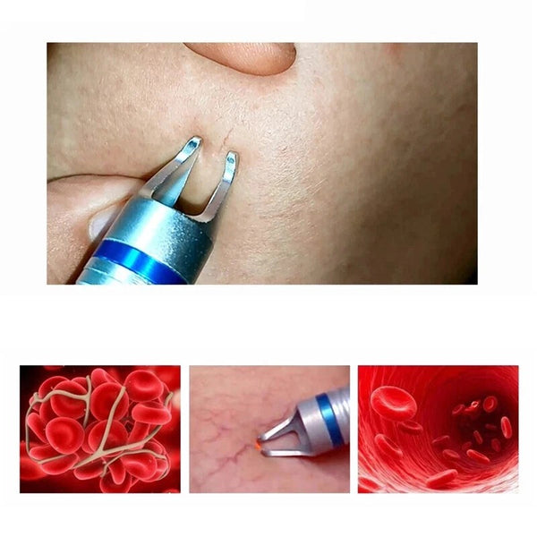 Pro 980nm Laser Spider Vein Vascular Removal Skin Rejuvenation Cold Hammer 2in1