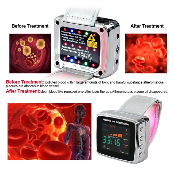 650nm Laser 13 Holes Physiotherapy Wrist Watch LLLT Treat for Hypertension