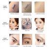 Portable Non-Invasive Q Switch Pico Laser Tattoo Removal Machine Nd YAG 1064nm