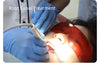 Dental Ultrasonic Plaque Remover Scaler Piezo LED Handpiece Tips Teeth Cleaning