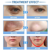 15 In 1 Hydra Dermabrasion Water Hydro Deep Cleansing Facial Skin Care Machine