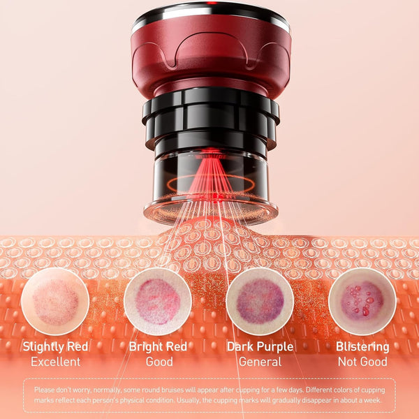 Electric Cupping Therapy Smart Scraping Massager Set 8 Massage Cups Red Light