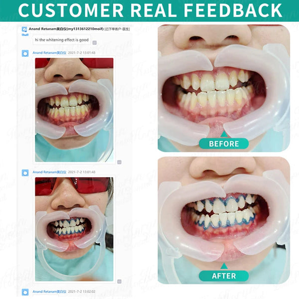 80W Lift Type Dental Cold Light Lamp Touch Screen Teeth Teeth Whitening Machine