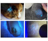 Dermatology Medical LED Woods Lamp Skin Analyzer For Vitiligo Wood's Lamp Skin