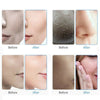10in1 Water Dermabrasion Deep Cleansing Hydro Hydra Dermabrasion Facial Machine