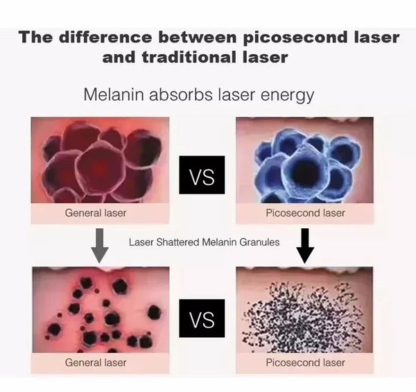 Diode Laser Hair Removal Machine Picosecond Tattoo Removal Nd Yag Wavelength AU