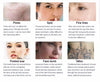 Diode Laser Hair Removal Machine Picosecond Tattoo Removal Nd Yag Wavelength AU