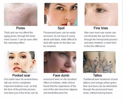 Diode Laser Hair Removal Machine Picosecond Tattoo Removal Nd Yag Wavelength AU