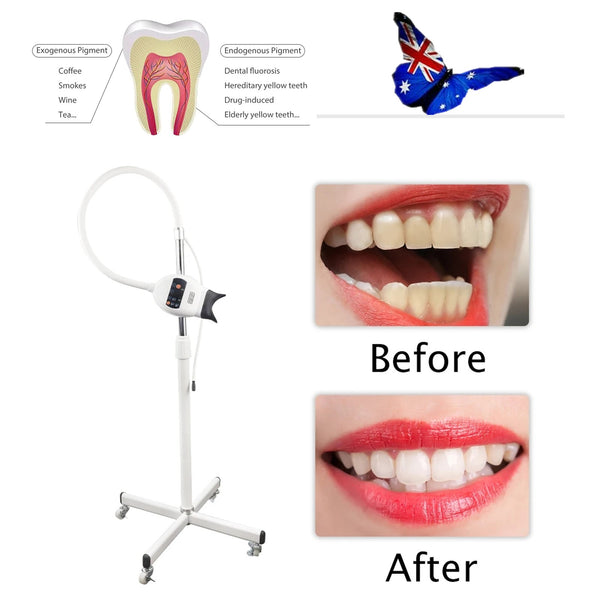 Mobile Dental Teeth Whitening Machine Bleaching Accelerator Light 3 Color Modes