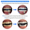 Mobile Dental Teeth Whitening Machine Bleaching Accelerator Light 3 Color Modes