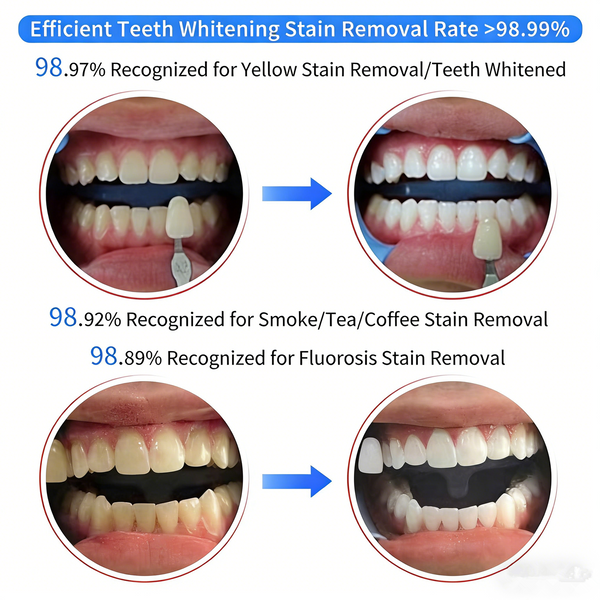 Mobile Dental Teeth Whitening Machine Bleaching Accelerator Light 3 Color Modes
