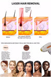 Diode Laser Hair Removal Machine Picosecond Tattoo Removal Nd Yag Wavelength AU