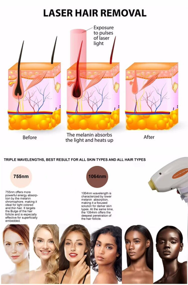 Diode Laser Hair Removal Machine Picosecond Tattoo Removal Nd Yag Wavelength AU