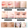 Professional 7 Color LED Facial Photon Light Therapy PDT Lamp Skin Beauty Device