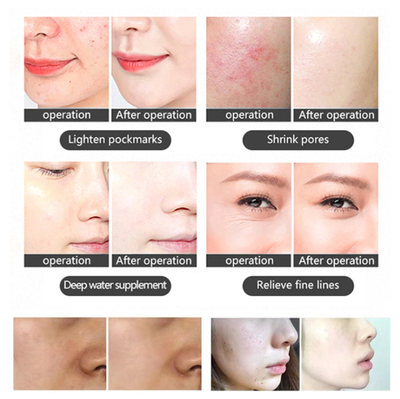 Professional 7 Color LED Facial Photon Light Therapy PDT Lamp Skin Beauty Device