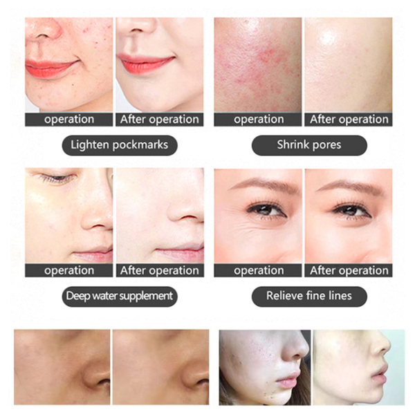 Professional 7 Color LED Facial Photon Light Therapy PDT Lamp Skin Beauty Device