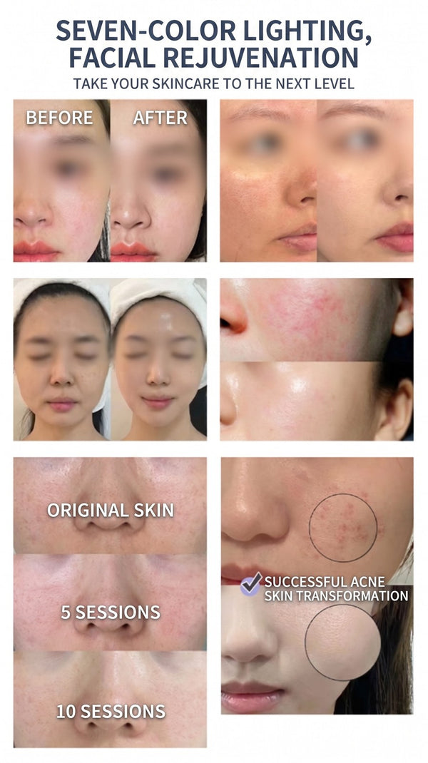 Professional 7 Color LED Facial Photon Light Therapy PDT Lamp Skin Beauty Device