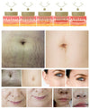 RF Micro-ne-edling Machine w/Cold Hammer-Anti-Aging,Pore Tightening 4 Cartridges