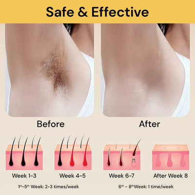 Photoepilator IPL Hair Removal Laser 900000 Flashes Epilator Permanent Laser