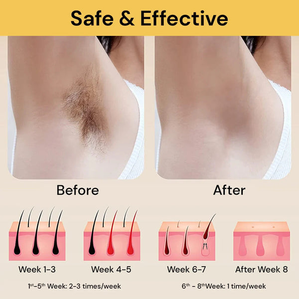 Photoepilator IPL Hair Removal Laser 900000 Flashes Epilator Permanent Laser