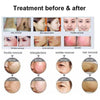 Beauty Salon IpL E Light OPT Painless Laser Permanent Hair Removal Machine